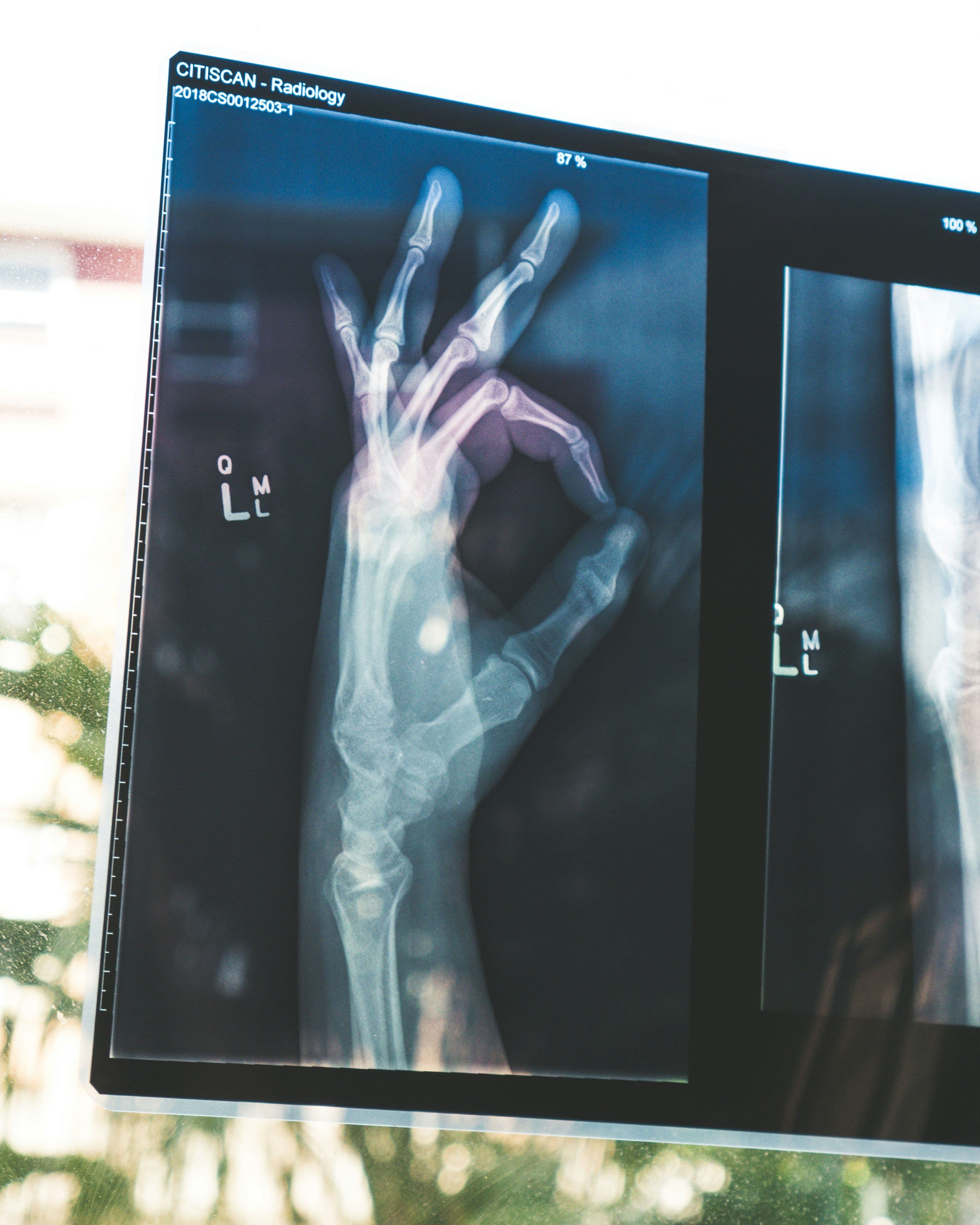 Main Image: X-ray, tech in Medicine